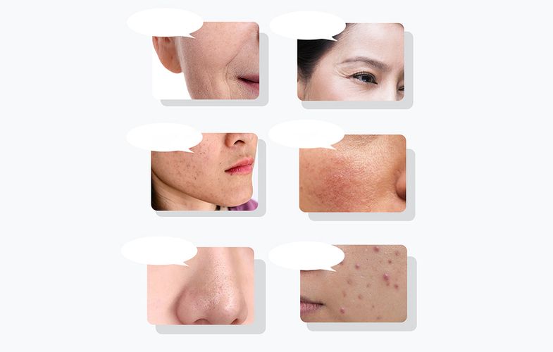 Ultrasonic facial massager with light therapy ANLAN 01-ADRY15-001, ANLAN 01-ADRY15-001