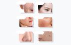 Ultrasonic facial massager with light therapy ANLAN 01-ADRY15-001, ANLAN 01-ADRY15-001