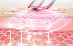 Eye Massager EMS ANLAN 08-AMYY31-02A, ANLAN 08-AMYY31-02A